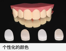 極薄強(qiáng)韌氧化鋯貼面技術(shù)，一款免磨牙貼面技術(shù)