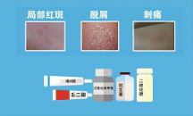 祛痘藥哪個好用？七味姜黃搽劑憑實(shí)力“出圈”，祛痘又猛又柔！